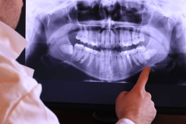 Best Emergency Treatment for Oral Infections in Westminster, CA